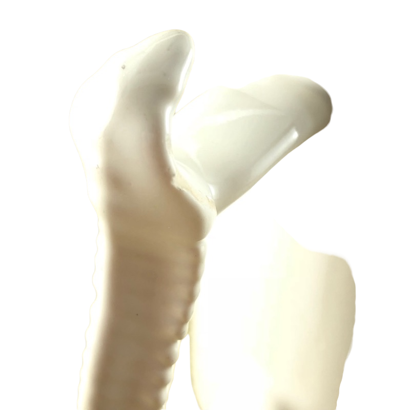 Human Spine 3D Handle White Mug
